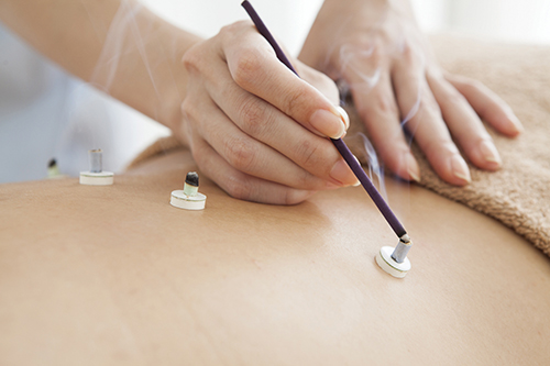 Women wearing the fire moxibustion