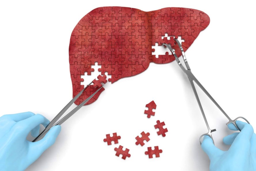 190801-Aca1-des-f1-hepatitis